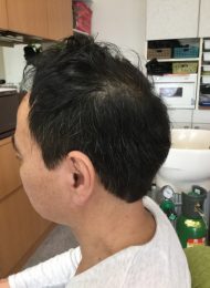 カット　集中育毛ケア　ヘアエステ　４０代男性