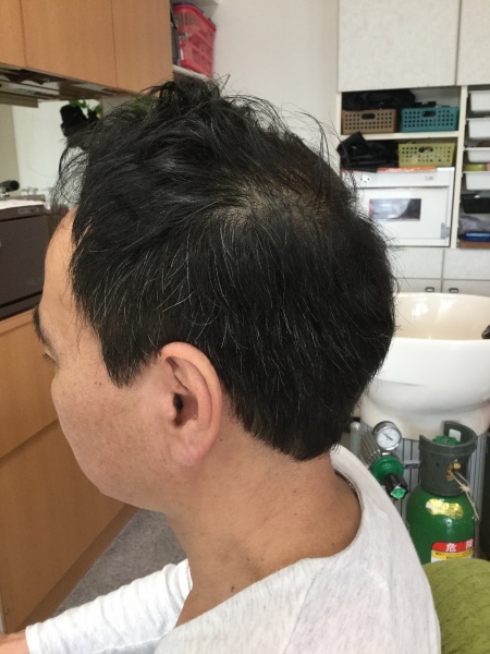 カット　集中育毛ケア　ヘアエステ　４０代男性