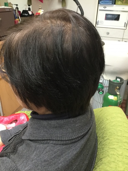 カット　ヘアエステ　集中育毛ケア　60代