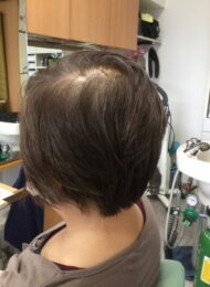 カラーリング　カット　集中育毛ケア　ヘアエステ　40代