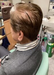 カット　カラーリング　集中育毛ケア　ヘアエステ　60代男性